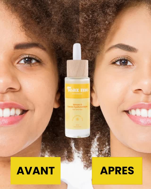 ✨ Avant / Après bluffant ✨
Dites adieu aux ridules d’expression et bonjour à une peau lisse, hydratée et éclatante 🌸

Notre sérum à l’acide hyaluronique et aloe vera :
💧 Lisse les ridules liées à l’âge
🌿 Matifie le teint pour un effet peau nette
⚡ Hydrate en profondeur pour une peau repulpée et confortable

Un seul geste dans ta routine et ta peau retrouve son glow naturel ✨

👉Des résultats dès de 7 jours d’utilisation
#serum #acidehyaluronique #morningroutine #teazme #peauéclatante